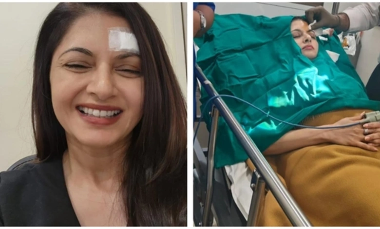 Bhagyashree Suffers Injury During Pickleball Game, Receives 13 Stitches