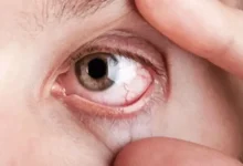 Screen Time's Impact on Dry Eyes: What You Need to Know and How to Protect Your Eyes