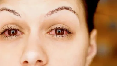 Mumbai Braces for Surge in Eye Infections as Monsoon Season Begins 16 Days Early