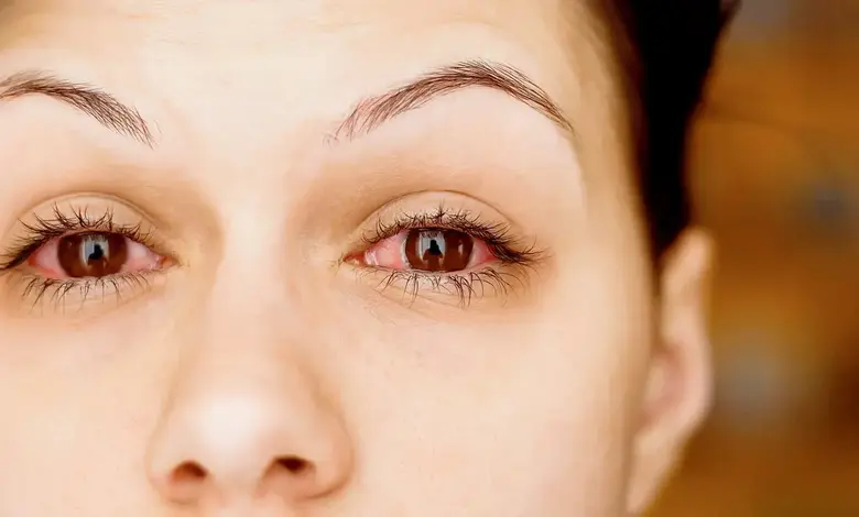 Mumbai Braces for Surge in Eye Infections as Monsoon Season Begins 16 Days Early