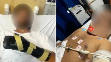 Indian-Origin Man Survives Brutal Machete Attack by Teen Gang in Melbourne