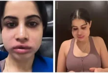 Uorfi Javed Faces Trolls with Humor After Lip Filler Removal
