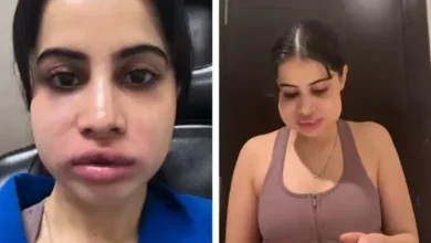Uorfi Javed Faces Trolls with Humor After Lip Filler Removal