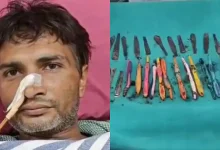 35-Year-Old UP Man Swallows 29 Spoons, 19 Toothbrushes, 2 Pens At Rehab