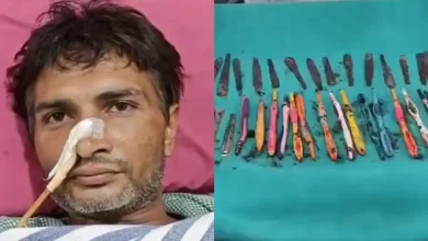 35-Year-Old UP Man Swallows 29 Spoons, 19 Toothbrushes, 2 Pens At Rehab