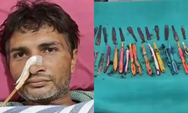 35-Year-Old UP Man Swallows 29 Spoons, 19 Toothbrushes, 2 Pens At Rehab