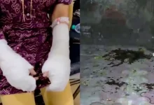 Delhi Acid Attack Case Sees New Twist: Police Question Key Suspect’s Location; No Cctv or Acid Traces