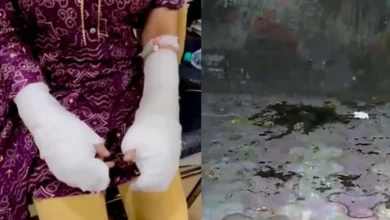Delhi Acid Attack Case Sees New Twist: Police Question Key Suspect’s Location; No Cctv or Acid Traces