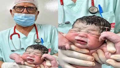 In One-in-a-Million Birth, Brazilian Newborn Arrives Clutching the IUD Meant to Prevent His Pregnancy