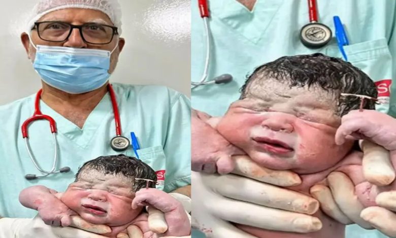 In One-in-a-Million Birth, Brazilian Newborn Arrives Clutching the IUD Meant to Prevent His Pregnancy