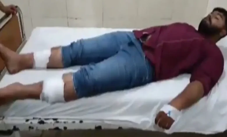 Junagadh Violence: Youth Brutally Attacked with Rods and Pipes; Folk Artist Rajbha Gadhvi’s Relatives Accused