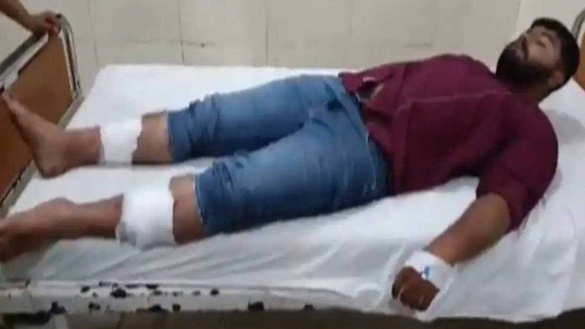 Junagadh Violence: Youth Brutally Attacked with Rods and Pipes; Folk Artist Rajbha Gadhvi’s Relatives Accused