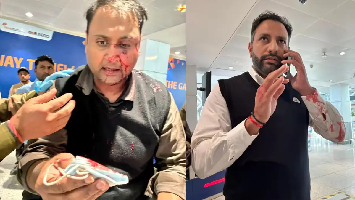 SpiceJet passenger has accused an Air India Express pilot of physically assaulting him during a dispute.