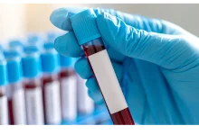 Ahmedabad: ‘Black Blood’ Medical Rs 6.7 lakh Scam Targeting Elderly Busted; Bank Manager’s Alert Leads To Arrest