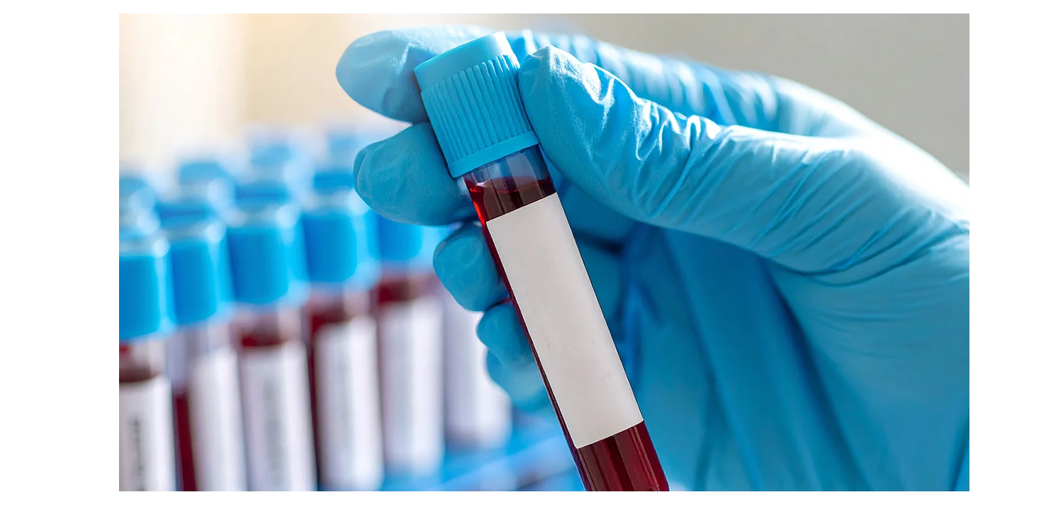 Ahmedabad: ‘Black Blood’ Medical Rs 6.7 lakh Scam Targeting Elderly Busted; Bank Manager’s Alert Leads To Arrest