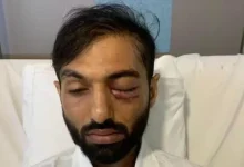 Mumbai Commuter Blinded In One Eye After Stone Misses Target In Train Argument