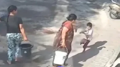 Nagpur: 4-Year-Old Boy Suffers 45% Burns After Grandmother Allegedly Douses Him With Boiling Water During Holi Celebrations