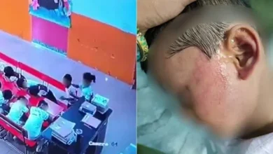 Lucknow: Nursery Student Allegedly Beaten For 8 Minutes By Class Monitor After Teacher Left Classroom
