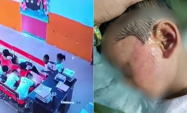 Lucknow: Nursery Student Allegedly Beaten For 8 Minutes By Class Monitor After Teacher Left Classroom