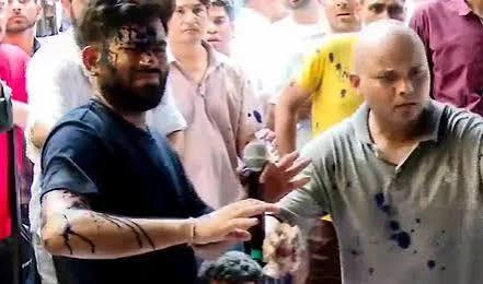 Abhijeet Dipke Inked At Jantar Mantar; Kejriwal Launches Fresh Attack On BJP
